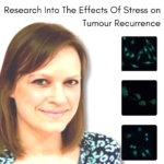 ***UPDATE*** Research Into The Effects Of Stress on Tumour Recurrence